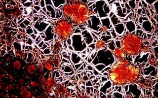 野趣微观鉴赏，野外石头标本微观纹理观察